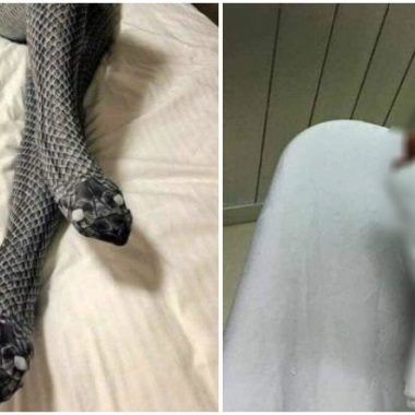 Mulher tem as pernas quebradas pelo marido que confundiu meia-calça com uma cobra Mulher tem as pernas quebradas pelo marido que confundiu meia-calça com uma cobra