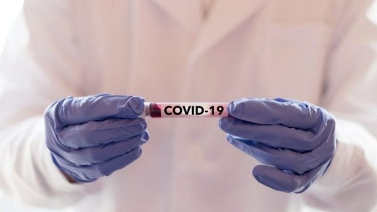 CORONAVÍRUS - Rondônia registra 302 novos casos de Covid-19 e mais cinco mortes 18 CORONAVÍRUS - Rondônia registra 302 novos casos de Covid-19 e mais cinco mortes