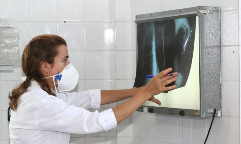 Pandemia reduz avanços no combate à tuberculose, diz especialista 7 Pandemia reduz avanços no combate à tuberculose, diz especialista