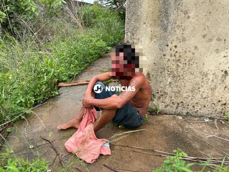 Homem é encontrado agonizando com vários ferimentos na cabeça; vídeo 4 Homem é encontrado agonizando com vários ferimentos na cabeça; vídeo