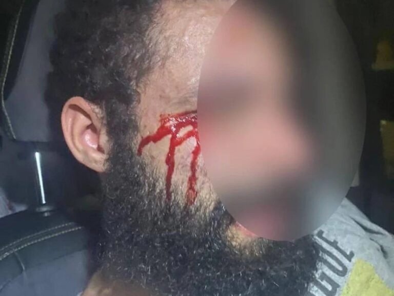 Médica que mandou cortar pênis do ex-noivo é acusada de agredir marido 15 Médica que mandou cortar pênis do ex-noivo é acusada de agredir marido