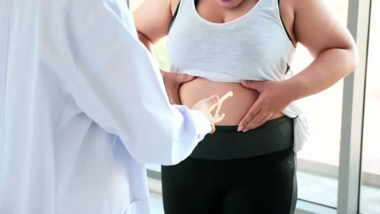 Porto Velho é capital com maior porcentagem de adultos com excesso de peso e obesidade 16 Porto Velho é capital com maior porcentagem de adultos com excesso de peso e obesidade