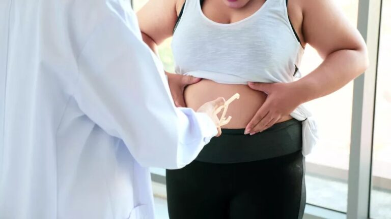 Porto Velho é capital com maior porcentagem de adultos com excesso de peso e obesidade 17 Porto Velho é capital com maior porcentagem de adultos com excesso de peso e obesidade