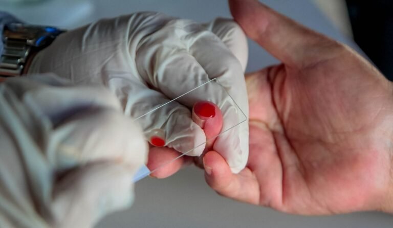 Estudo sobre a implantação de medicamento inovador no tratamento da malária tem participação do Centro de Pesquisa de Rondônia 17 Estudo sobre a implantação de medicamento inovador no tratamento da malária tem participação do Centro de Pesquisa de Rondônia